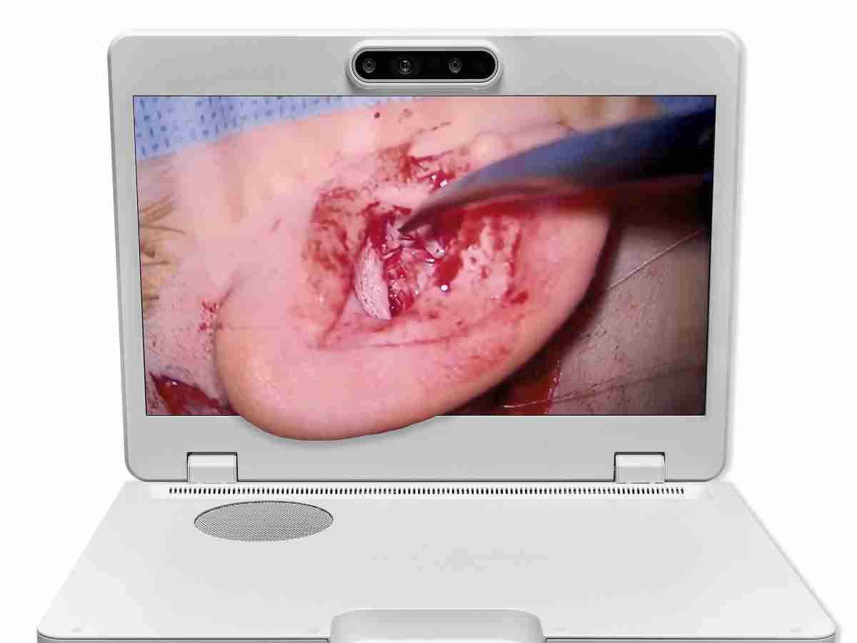 达擎之＂Heads-up 3D显微手术显示系统＂，，整合4K裸眼3D显示及眼球追踪系统，，具备快速追踪人眼移动位置功能，，减轻医师长时间维持固定姿势的负担，，，让医师能有更宽广清晰的3D立体视野及更舒适的姿势来执行手术。。